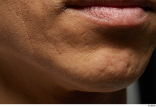 HD Face skin references Chikanari Ryosei lips mouth scar skin…